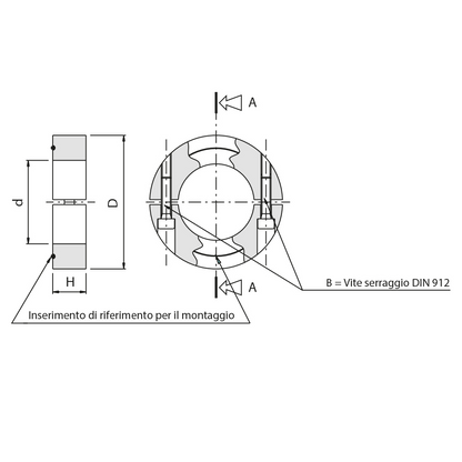 Anello bloccaggio radiale 2T